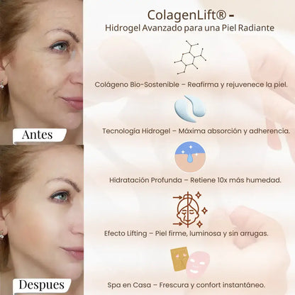 Resultados reales de ColagenLift® - Antes y después de 3 días de uso.